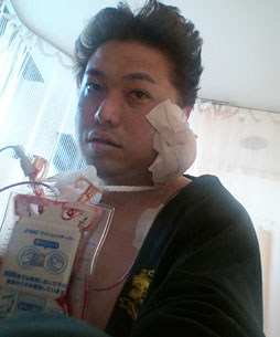 西川善司】腫瘍摘出手術を受けて自らがバイオハザード風になった話