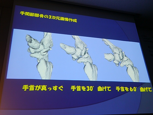 医療研究の成果とunityが結びついて人体解剖学アプリ Teamlabbody に Unityソリューションカンファレンス オタクが医療を救う 聴講レポート