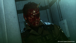 ꡼ No.036Υͥ / E3 2015ϡMETAL GEAR SOLID V: THE PHANTOM PAINץߥå󳫻ϤޤǤή줬ǧǤץ쥤ǥݡȡݶϻṳ̂Τ