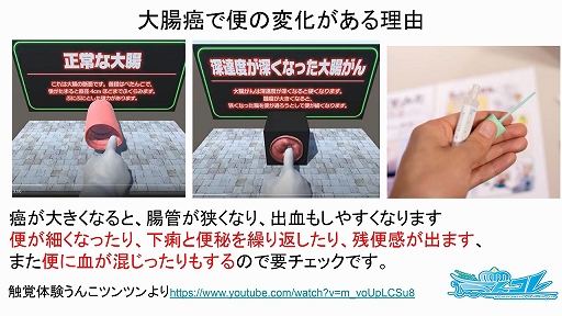 画像ギャラリー No.005のサムネイル画像 / 大腸癌早期発見を目指すスマホアプリ「うんコレ」のリリース報告会をレポート。2週間で報告されたプレイヤーの推定総うんこ重量は約12万トン