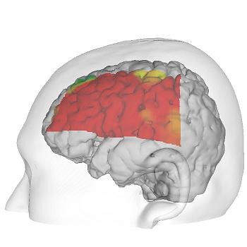 ���������꡼ No.004�Υ���ͥ������ / �֤פ�פ�e���ݡ��ġפ��Ѥ���Ǿ��ư�¸��η�̤������ˡ��ץ쥤���Ǿ�ν������̤γ��������¬