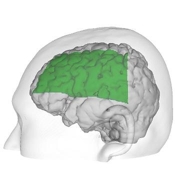 ���������꡼ No.005�Υ���ͥ������ / �֤פ�פ�e���ݡ��ġפ��Ѥ���Ǿ��ư�¸��η�̤������ˡ��ץ쥤���Ǿ�ν������̤γ��������¬