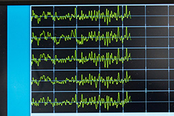 画像ギャラリー No.009のサムネイル画像 / 脳活動だけでロボットを操作する「bスポーツ」を体験。「Brain-machine Interface」がゲームを変える