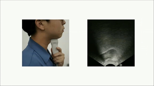 ꡼ No.007 | CEDEC 2021Ͽʹ֤ǽϤĥ֥ҥ塼ޥ󥪡ơפȤϡͤAIͻˤäƵꤦҲ¤Ѳ