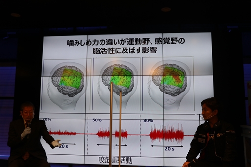 画像ギャラリー No.007のサムネイル画像 / ウメハラ氏が登壇した「ロッテ『プロフェッショナルガム』贈呈式」レポート。ガムの咀嚼はeスポーツのパフォーマンスアップにも貢献する