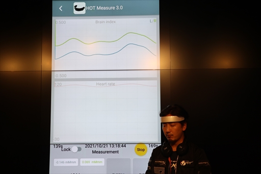 画像ギャラリー No.008のサムネイル画像 / ウメハラ氏が登壇した「ロッテ『プロフェッショナルガム』贈呈式」レポート。ガムの咀嚼はeスポーツのパフォーマンスアップにも貢献する